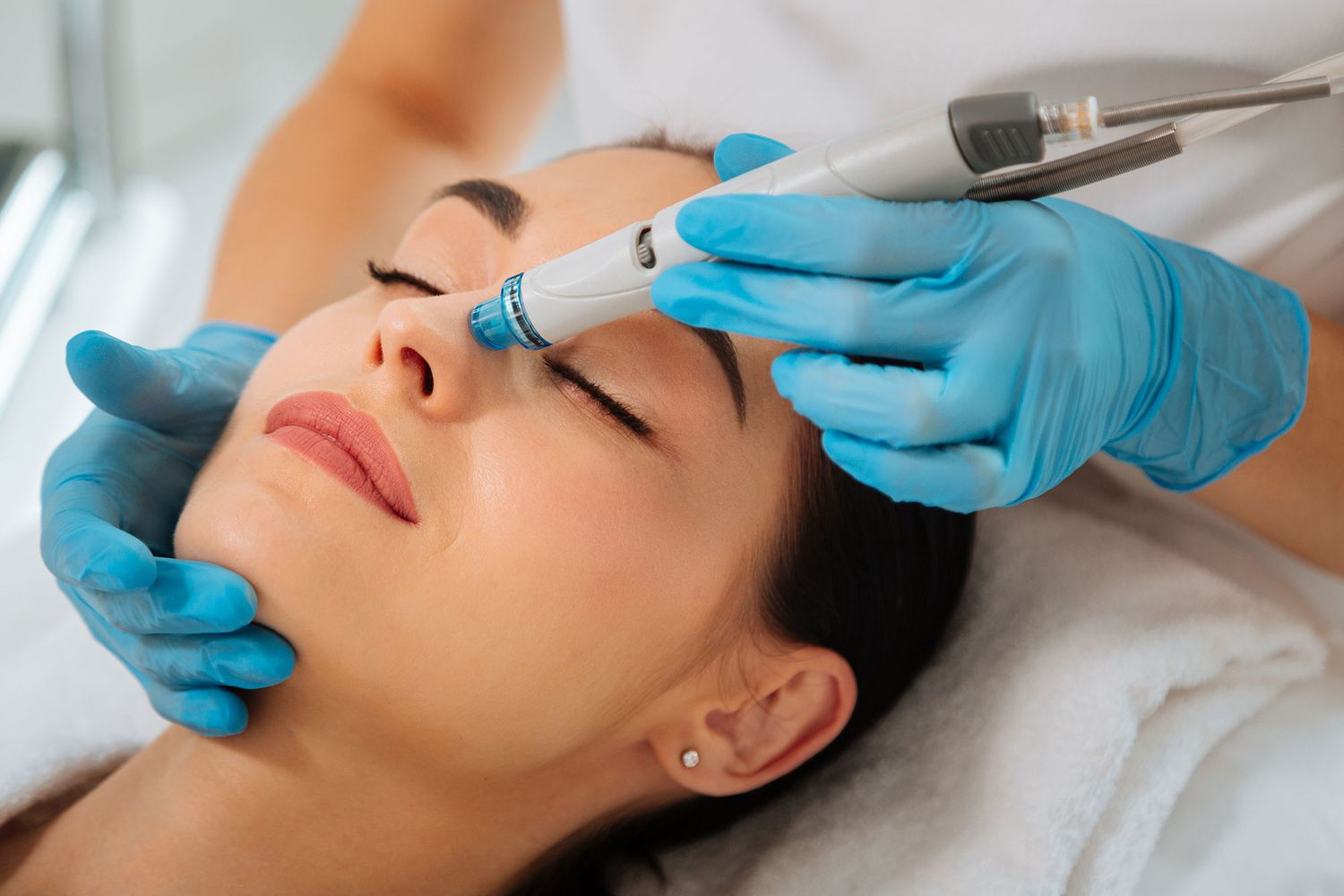 Why You Should Get a HydraFacial in Summer?